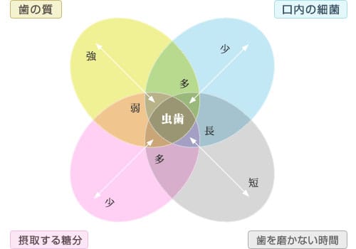 虫歯(う蝕)の4つの原因