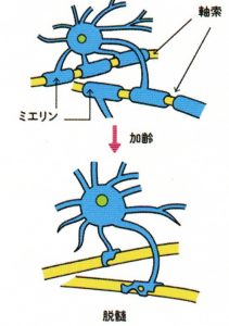 神経細胞線維とミエリン鞘の図